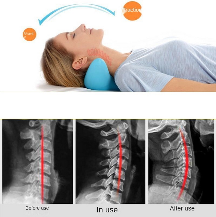 Almohada de masaje de columna cervical, masajeador de cuello de acupresión por gravedad, almohada de columna cervical, almohada de masaje de hombros y cuello, corrector de tracción para el hogar